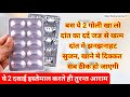Just 2 Tablets Will Eliminate Toothache From Its Roots Dant Dard Ki Tablet Dant Dard Ka Ilaj