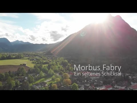 Morbus Fabry – a Rare fate