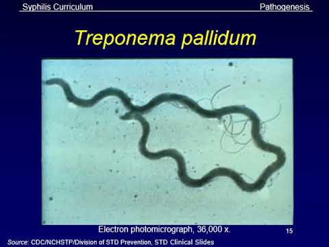 Papillomavirus amygdales