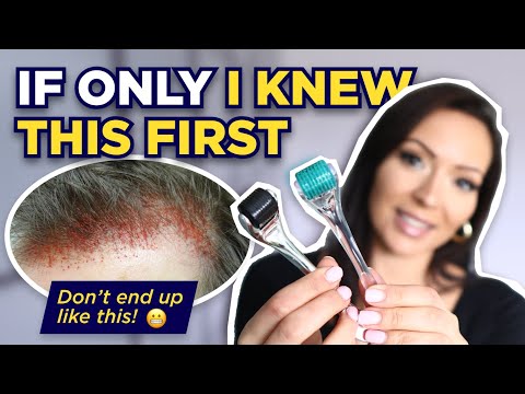 The Dermaroller: Watch This BEFORE Microneedling! (What I wish I knew Before I Started Dermarolling)
