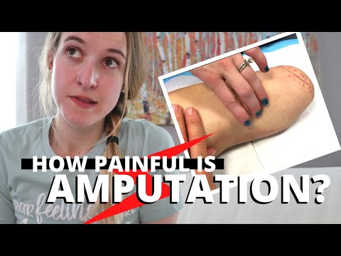 How BAD Does AMPUTATION Hurt??