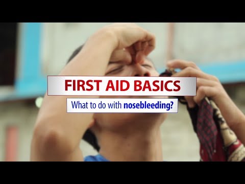 Basic first aid treatment for nosebleeds
