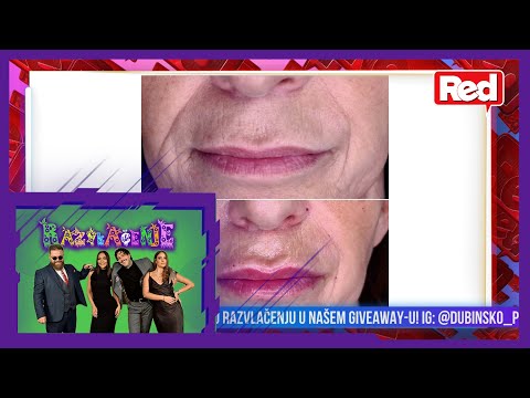 O nadrilekarima plastične hirurgije - Razvlačenje - 21.10.2021. - Red TV
