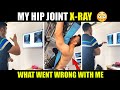 How NOT to DESTROY your LOWER BACK and HIP JOINT [Reasons & Prevention]