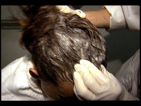Head Lice - Treatment