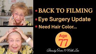 I'M BACK TO FILMING  EYE SURGERY UPDATE