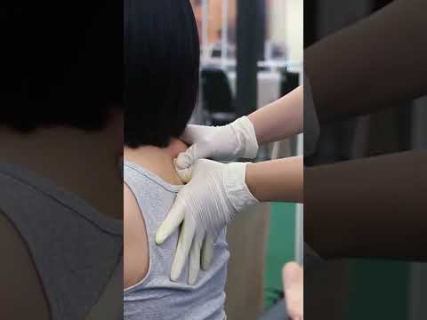 อาการ
