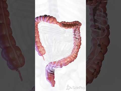 💧 Understanding Diarrhea: Causes and Care 💧  #anatomy #meded #3danimation