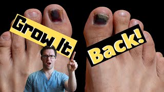 Toenail Falling Off? How To Make It Grow Back! [Top 4 Causes]