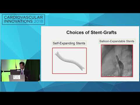 CVI2018 Session: CVI Fellow to Faculty: Case presentation - Faisal Latif, MD