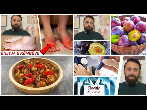 Rreze Dielli - Emisioni 22 Tetor 2025, Receta/ Mit apo fakt/ Enjtja e këmbëve / Vlerat e kumbullës