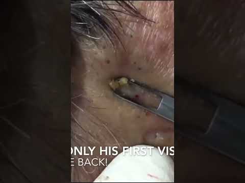 A Satisfying Extraction You Can't Miss