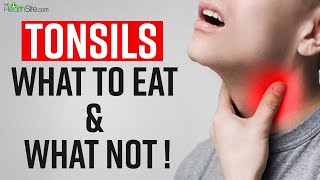 Tonsils Remedies: What To Eat And What To Avoid In Tonsils | Sore Throat Treatment