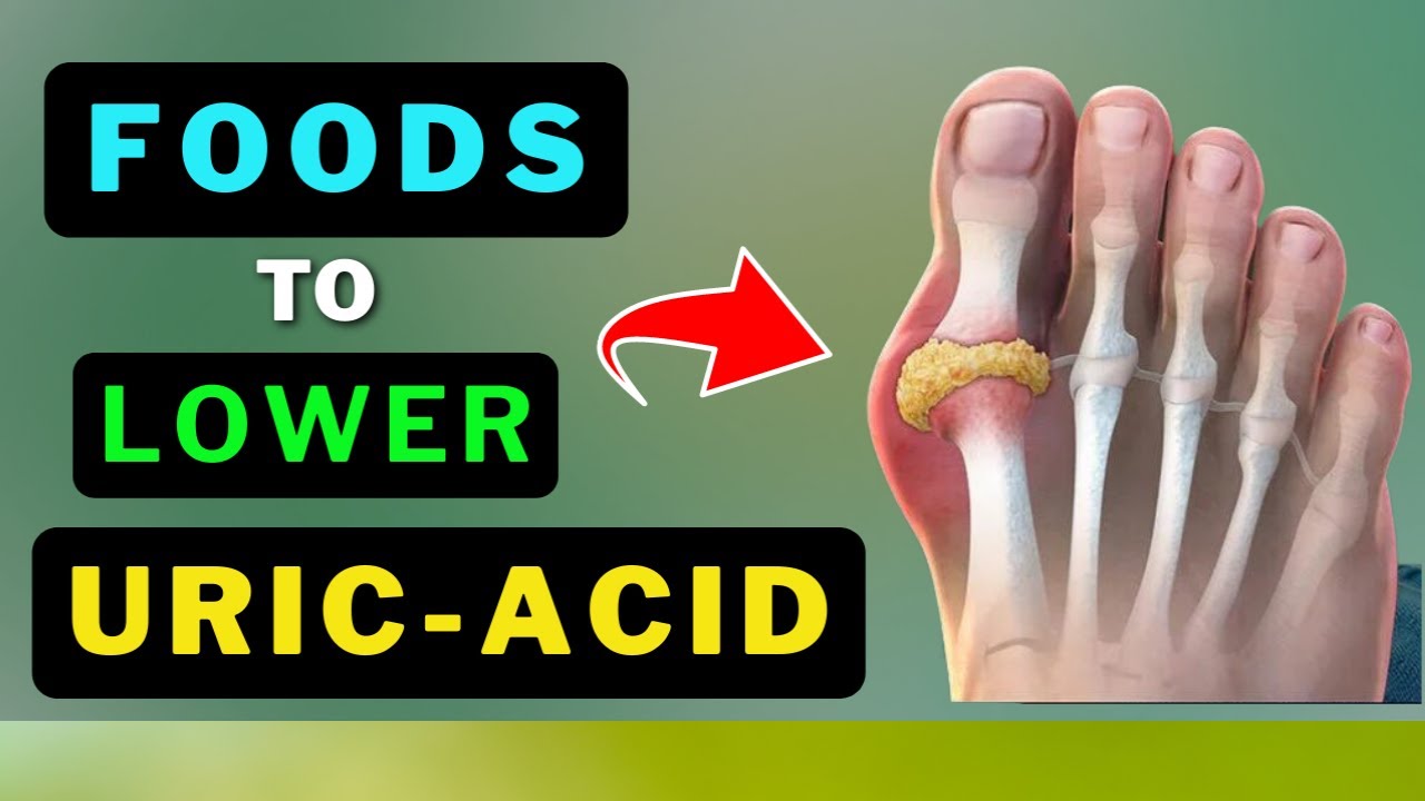 Amazing Foods That Lower Uric Acid - Find Out Now!