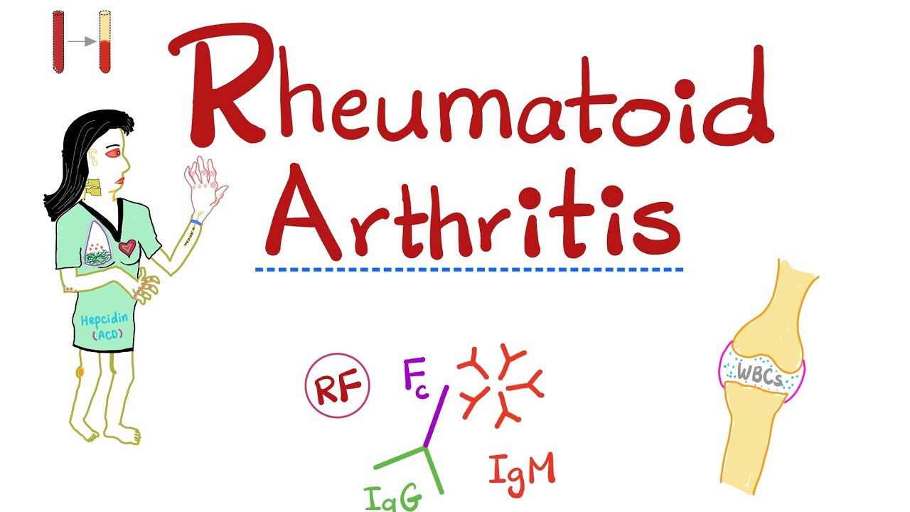 Rheumatoid Arthritis (Part 8): Diagnosis - YouTube