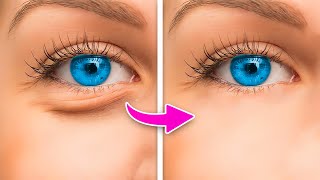 HOW TO: MAKE UNDER EYE BAGS DISAPPEAR IN SECONDS!!!!