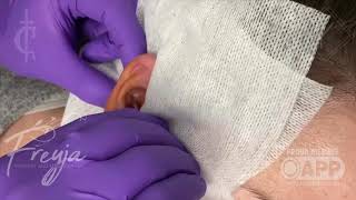 Conch Piercing