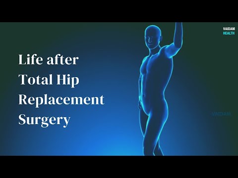 Life after Total Hip Replacement Surgery