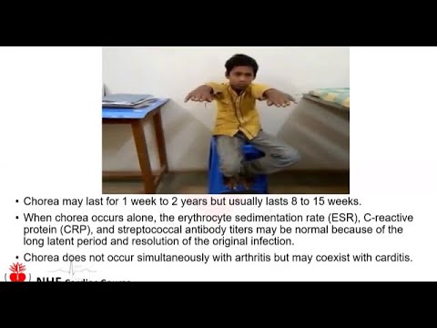 Acute Rheumatic Fever