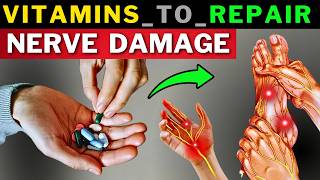Top 7 Vitamins to Prevent & Repair Nerve Damage