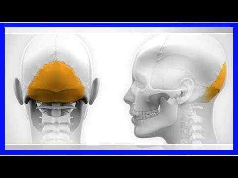 download lagu mp3 mp4 Arnoldite, download mp3 Arnoldite free download mp3, download mp3 Arnoldite