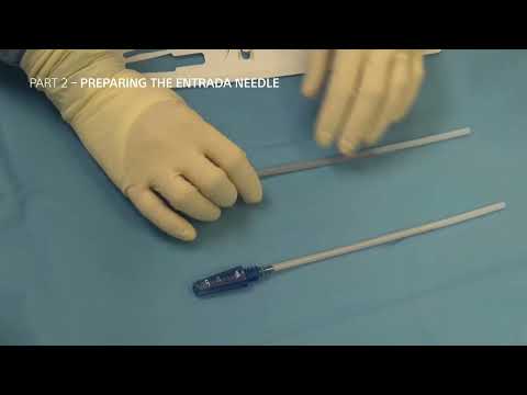 Dr. Georgios Matis - Neuromodulation - Spinal cord stimulation - Preparing the BSC Entrada needle