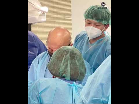 Dr. Chen Deep SMAS Face Lift ✨ ทำครั้งเดียว อยู่ได้นาน Dr. Chen Deep SMAS Face Lift ✨ ทำครั้งเดียว อยู่ได้นาน