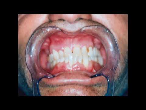 Medical Detectives Kalte Herzen