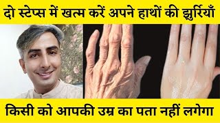 How to Stop AGING HANDS I Reduce Wrinkles I Dry, Thinning skin I Home remedies I DR. MANOJ DAS