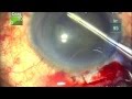 Complicated Cataract and Glaucoma Surgery ...