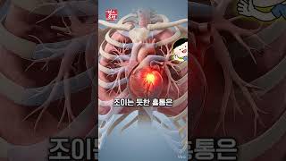 가슴 통증 절대 무시하지 마세요 ???? 심근경색 초기 증상과 응급 대처법 [통증 경고 시리즈 1편] #shorts #심장건강