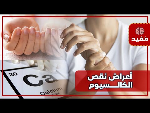 تعرَّف على أعراض نقص الكالسيوم لديك والمصادر الطبيعية للحصول عليه