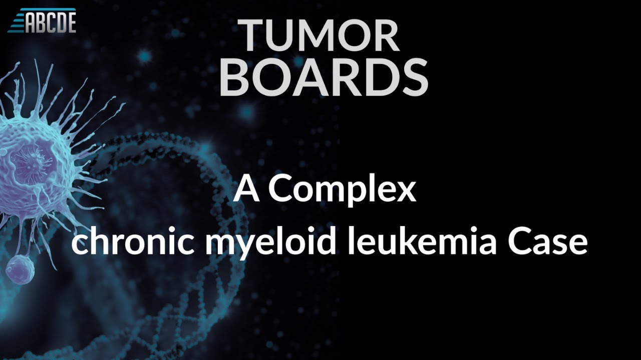 Managing CML and Chronic GVHD: Multidisciplinary Perspectives from  ABCDE Tumor Board.