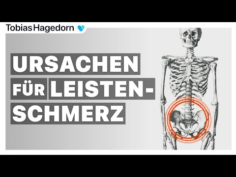 Groin pain ✖️ | Causes of groin pain