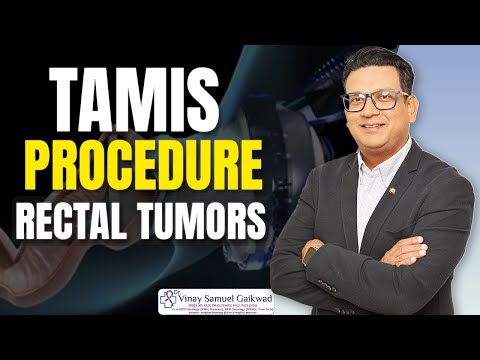 TAMIS Procedure: Invasive Approach for Rectal Tumors | Dr Vinay Samuel Gaikwad #rectal #tumors