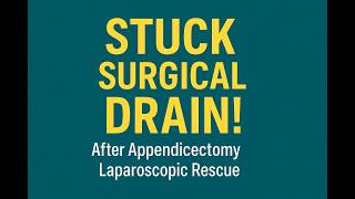 Rare Complication Stuck Surgical Drain After Appendicectomy  Laparoscopic Rescue by dr samrat jankar