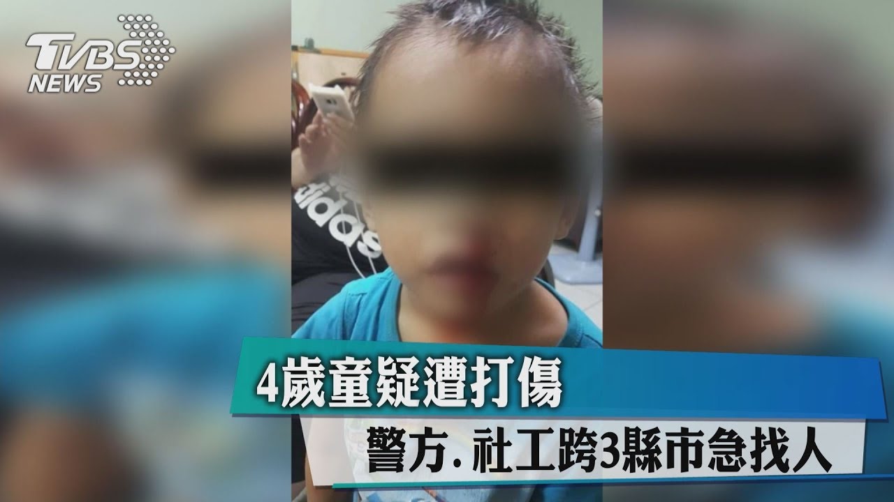 4歲童疑遭打傷　警方、社工跨3縣市急找人