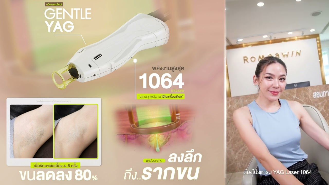 รีวิว YAG Laser 1064 เลเซอร์กำจัดขนหลุดถึงรากโคน โดยคุณน้ำหวาน Zaza