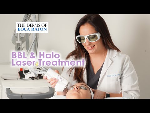 The Derms of Boca Raton | BBL Laser Treatment with...