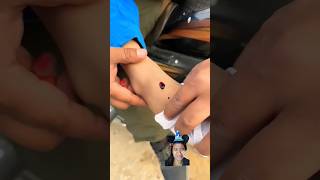 Download lagu Kasihan, Kakinya Berdarah #shorts #short #youtubeshorts #fyp #viral #trending #ช่องยูทูป #ฝากติดตาม mp3