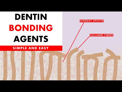 Dentine Bonding Agents