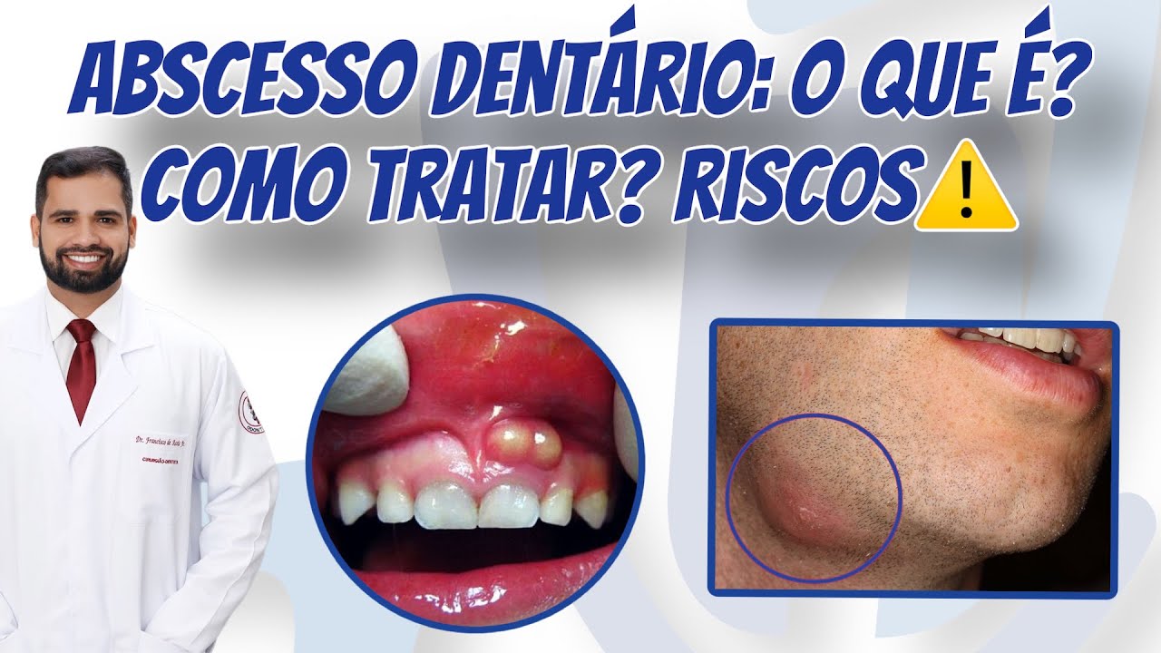 Francisco De Assis Almeida Lima Júnior-51