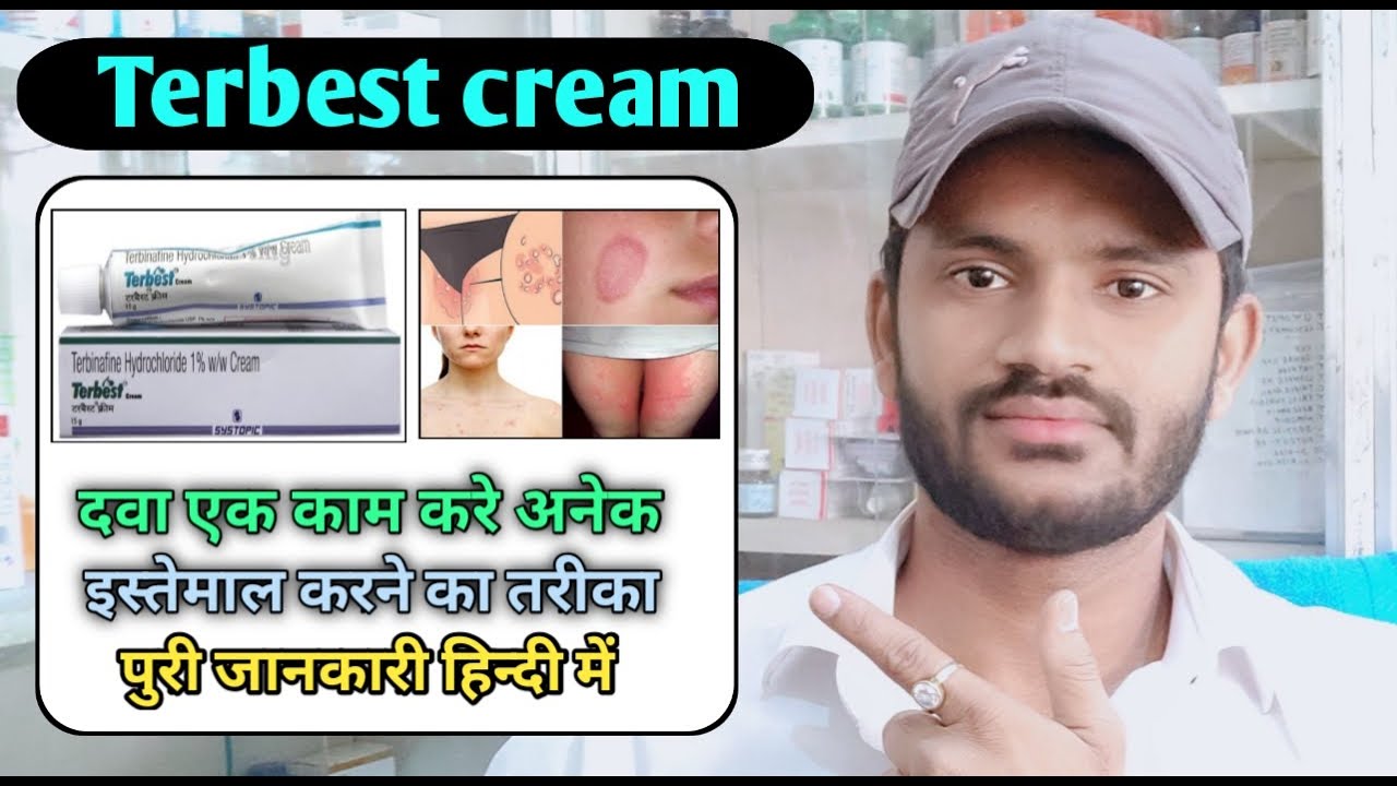 Terbest cream use benefits and Side effects full review in hindi/Terbinafine 1%