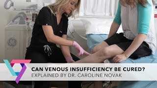 Can Venous Insufficiency Be Cured?