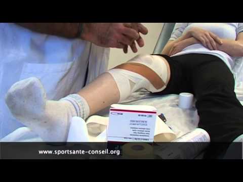 comment soigner ligament interne du genou