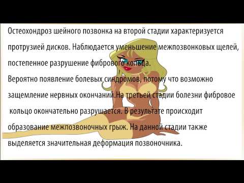 Снимок дисплазии тазобедренных суставов у собак Боль в шее в пояснице и плече