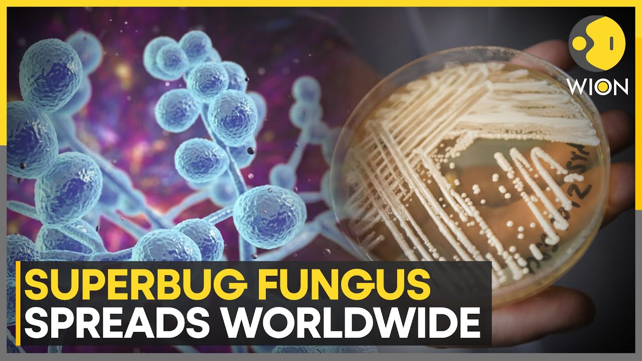 Superbug Fungus on the Rise Worldwide, Experts Warn of Troubling Strains | WION