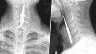 Suicide Commando - A6/ Crowling In Pain