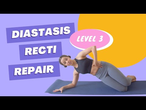 Diastasis Recti Repair Workout | Level 3
