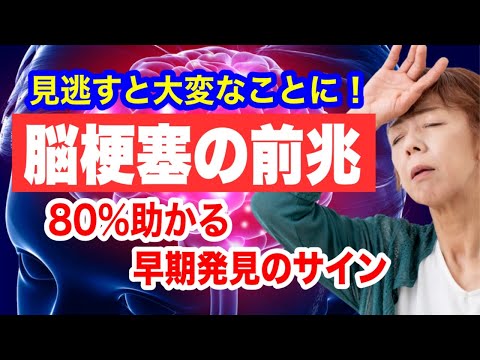 脳卒中の5つの主な症状とその対処法